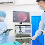 colonoscopy procedure